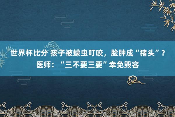 世界杯比分 孩子被蠓虫叮咬，脸肿成“猪头”？医师：“三不要三要”幸免毁容